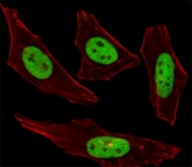 Fluorescent image of HeLa cells stained with SUMO2/3 antibody was diluted at 1:100 dilution. An Alexa Fluor 488-conjugated goat anti-rabbit lgG was used as the secondary Ab (green). Cytoplasmic actin was counterstained with Alexa Fluor 555 conjugated with Phalloidin (red).