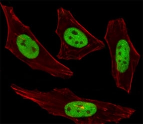 Fluorescent image of HeLa cells stained with SUMO2/3 antibody was diluted at 1:100 dilution. An Alexa Fluor 488-conjugated goat anti-rabbit lgG was used as the secondary Ab (green). Cytoplasmic actin was counterstained with Alexa Fluor 555 conjugated with Phalloidin (red).