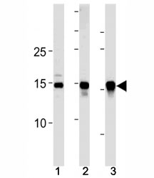 SUMO2/3 antibody western blot analysis in (10 U251 cells, (2) mouse liver and (3) rat liver lysate.