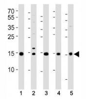 Western blot analysis of lysate from (1) 293T, (2) HeLa, (3) HL-60, (4) Jurkat cell lines and (5) rat liver tissue using SUMO2/3 antibody at 1:1000.