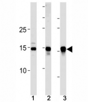 SUMO2/3 antibody western blot analysis in (10 U251 cells, (2)  mouse liver and (3) rat liver lysate.