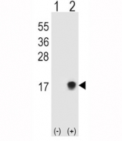 Western blot testing of SUMO2/3 antibody and 293T cell lysate either nontransfected (Lane 1) or transiently transfected (Lane 2) with the SUMO3 gene.