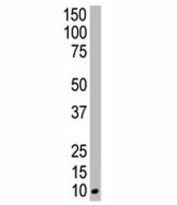 Western blot analysis of NEDD8 antibody and HeLa cell lysate. Predicted molecular weight ~9 kDa.