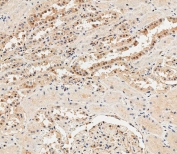 IHC staining of FFPE human kidney tissue with anti-Ubiquitin antibody. HIER: boil tissue sections in pH 9 10mM Tris with 1mM EDTA for 20 min and allow to cool before testing.