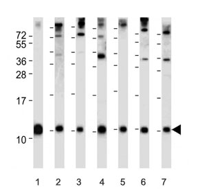 Western blot testing of 1) human 293, 2) human HeLa, 3) human HepG2, 4) human A549, 5) mouse NIH 3T3, 6) rat C2C12 and 7) rat C6 cell lysate with anti-Ubiquitin antibody. Predicted molecular weight ~8 kDa.