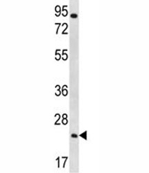 AQP5 antibody western blot analysis in NCI-H292 lysate
