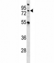 MST1 antibody western blot analysis in NCI-H460 lysate. Predicted molecular weight ~80 kDa.