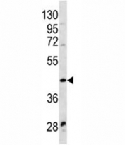 WNT9A antibody western blot analysis in NCI-H460 lysate
