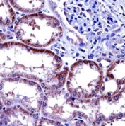 IL-6 antibody immunohistochemistry analysis in formalin fixed and paraffin embedded human kidney tissue.