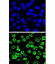 Confocal immunofluorescent analysis of MDM2 antibody with HeLa cells followed by Alexa Fluor 488-conjugated goat anti-rabbit lgG (green). DAPI was used as a nuclear counterstain (blue).