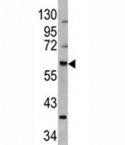 Western blot analysis of MDM2 antibody and 293 lysate. Predicted molecular weight: ~55 kDa but can be observed at up to ~90 kDa.