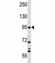 FAP antibody western blot analysis in NCI-H292 lysate.  Predicted molecular weight 88~95 kDa (monomer) and 170 kDa (dimer)