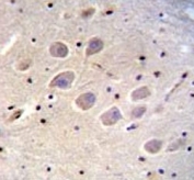 CD271 antibody immunohistochemistry analysis in formalin fixed and paraffin embedded human brain tissue.