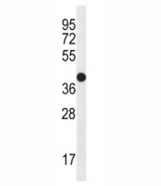 CD271 antibody western blot analysis in MDA-MB435 lysate. Predicted molecular weight ~45/75kDa (unmodified/glycosylated).