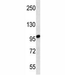 STIM2 antibody western blot analysis in uterus tumor lysate. Predicted molecular weight: 84/94/68 kDa (isoforms 1/2/3).~