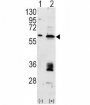 Western blot analysis of anti-MDM2 antibody and 293 cell lysate (2 ug/lane) either nontransfected (Lane 1) or transiently transfected with the MDM2 gene (2).