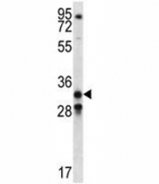 GDF15 antibody western blot analysis in NCI-H460 lysate. Predicted molecular weight ~34 kDa (pro-form) and ~25 kDa (mature form).