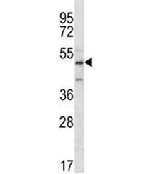 ABI2 antibody western blot analysis in Jurkat lysate. Predicted molecular weight ~55 kDa.