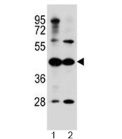 Western blot testing of human 1) A549 and 2) HepG2 celll lysate with ACSM6 antibody at 1:1000. Predicted molecular weight ~53 kDa.