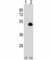 Western blot analysis of ASS1 antibody and 293 cell lysate either nontransfected (Lane 1) or transiently transfected (2) with the ASS1 gene.
