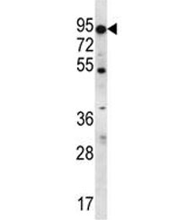 ABCD2 antibody western blot analysis in K562 lysate. Predicted molecular weight: ~83 kDa.