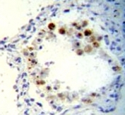 CDKN2B antibody immunohistochemistry analysis in formalin fixed and paraffin embedded human lung tissue