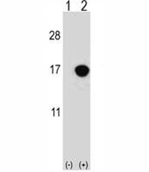 Western blot analysis of CDKN2B antibody and 293 cell lysate either nontransfected (Lane 1) or transiently transfected (2) with the CDKN2B gene.