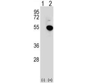 Western blot analysis of IRF4 antibody and 293 cell lysate (2 ug/lane) either nontransfected (Lane 1) or transiently transfected (2) with the IRF4 gene.~