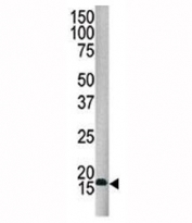 Western blot analysis of SUMO4 antibody and HepG2 lysate. Observed molecular weight: 11-15 kDa.