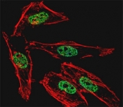 Fluorescent confocal image of HeLa cell stained with MyoD1 antibody at 1:25. MyoD immunoreactivity is localized to the nucleus.