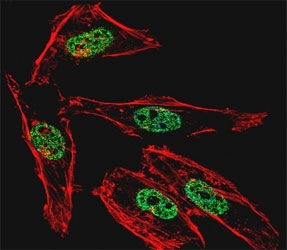 Fluorescent confocal image of HeLa cell stained with MyoD1 antibody at 1:25. MyoD immunoreactivity is