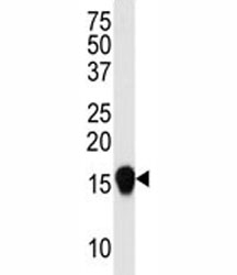 Western blot analysis of SUMO4 antibody (V55 Mutant) in HepG2 lysate. Observed molecular weight: 11-15 kDa.~