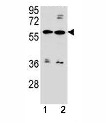ABCG4 antibody western blot analysis in MDA-MB453, ZR-75-1 lysate. Predicted molecular weight 60-80 kDa