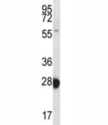 RAB27B antibody western blot analysis in MDA-MB435 lysate.~