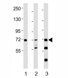 Western blot testing of SYK antibody at 1:2000 dilution. Lane 1: THP-1 lysate; 2: Ramos lysate; 3: mouse spleen lysate; Predicted molecular weight: 72 kDa.~