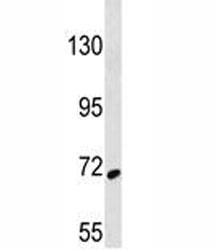 SYK antibody western blot analysis in 293 lysate
