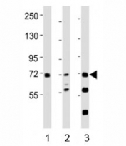 Western blot testing of SYK antibody at 1:2000 dilution. Lane 1: THP-1 lysate; 2: Ramos lysate; 3: mouse spleen lysate; Predicted molecular weight: 72 kDa.