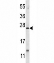 XBP1 antibody western blot analysis in mouse lung tissue lysate. Predicted molecular weight: ~29 kDa (isoform 1) and ~40 kDa (isoform 2).