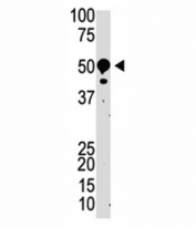 Western blot testing of SUV39H2 antibody and mouse kidney tissue lysate. Expected molecular weight: 40-53 kDa.