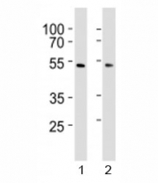 Western blot analysis of lysate from 1) HepG2 and 2) HUVEC cell line using SUV39H2 antibody at 1:1000. Expected molecular weight: 40-53 kDa.