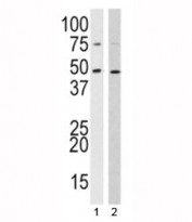 Western blot analysis of SUV39H2 antibody and 1) 293, 2) HL-60 lysate. Expected molecular weight: 40-53 kDa.