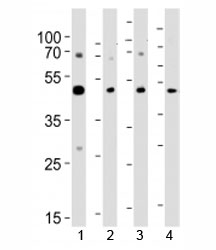 Western blot analysis of lysate from 1) A431, 2) K562, 3) CEM cell line and 4) rat brain tissue using SUV39H2 antibody at 1:1000.