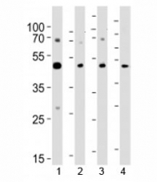 Western blot analysis of lysate from 1) A431, 2) K562, 3) CEM cell line and 4) rat brain tissue using SUV39H2 antibody at 1:1000. Expected molecular weight: 40-53 kDa.