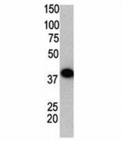 Western blot using SUMO2 antibody and GST-SUMO2 fusion protein.