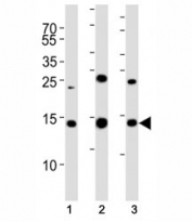 Western blot analysis of lysate from (1) 293T, (2) HL-60, (3) Jurkat cell line using SUMO2 antibody. Observed molecular weight: 12-15 kDa.