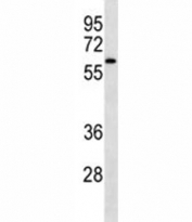 IRAK4 antibody western blot analysis in NCI-H460 lysate. Predicted molecular weight 52/37 kDa (isoforms 1/2).