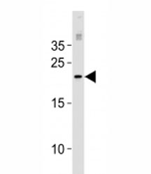 MGMT antibody western blot analysis in MCF-7 lysate.~