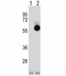 Western blot analysis of CTBP2 antibody and 293 cell lysate either nontransfected (Lane 1) or transiently transfected (2) with the CTBP2 gene.~