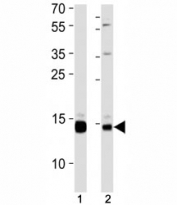 SUMO2/3 antibody western blot analysis in (1) 293 cell line and (2) rat liver tissue lysate. Observed molecular weight: 12-15 kDa.