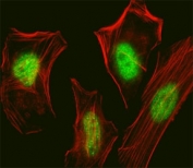 Fluorescent confocal image of HeLa cell stained with SUMO2/3 antibody. HeLa cells were fixed with 4% PFA (20 min), permeabilized with Triton X-100 (0.1%, 10 min), then incubated with primary Ab (1:25, 1 h at 37oC). For secondary Ab, Alexa Fluor 488 conjugated donkey anti-rabbit Ab (green) was used (1:400, 50 min at 37oC). Cytoplasmic actin was counterstained with Alexa Fluor 555 (red) conjugated Phalloidin (7units/ml, 1 h at 37oC). Nuclei were counterstained with DAPI (blue) (10 ug/ml, 10 min). immunoreactivity is localized to the nucleus.